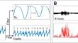 Central venous pressure waveform analysis during sleep/rest: a novel approach to enhance intensive care unit post-extubation monitoring of extubation failure.