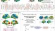 Atypical dynamic neural configuration in autism spectrum disorder and its relationship to gene expression profiles.