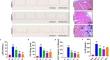 Anshen Shumai Decoction inhibits post-infarction inflammation and myocardial remodeling through suppression of the p38 MAPK/c-FOS/EGR1 pathway.