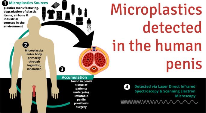 Detection of microplastics in the human penis.