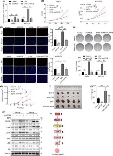 Unveiling the role of UPF3B in hepatocellular carcinoma: Potential therapeutic target