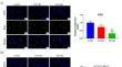 Iodine-125 seed inhibits proliferation and promotes apoptosis of cholangiocarcinoma cells by inducing the ROS/p53 axis