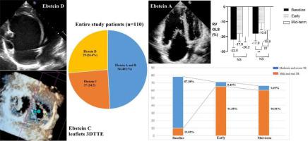 Biventricular function after Ebstein anomaly repair from a single-center echocardiography study.