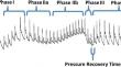 Valsalva maneuver pressure recovery time is prolonged following spinal cord injury with correlations to autonomically-influenced secondary complications.