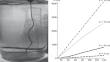 Vortex Convective Flows Formed during Ice Melting in Single-Component Media