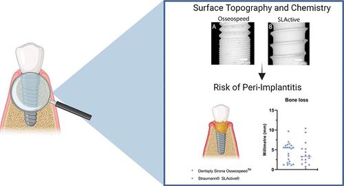 Surface Topography Has Less Influence on Peri-Implantitis than Patient Factors: A Comparative Clinical Study of Two Dental Implant Systems