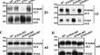 Specific sialylation of N-glycans and its novel regulatory mechanism.