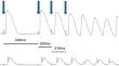 Electrophysiological Profile of Different Antiviral Therapies in a Rabbit Whole-Heart Model.