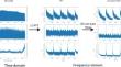 Encoding Time Series as Images for Anomaly Detection in Manufacturing Processes Using Convolutional Neural Networks and Grad-CAM