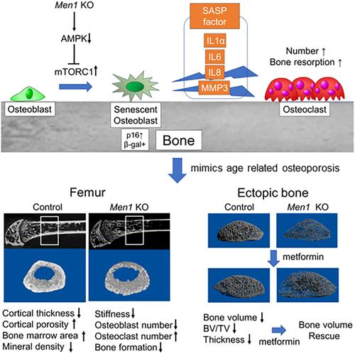 Cellular senescence by loss of Men1 in osteoblasts is critical for age-related osteoporosis