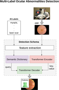 Multi-modality multi-label ocular abnormalities detection with transformer-based semantic dictionary learning.