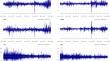 Dynamic Interlinkages between the Twitter Uncertainty Index and the Green Bond Market: Evidence from the Covid-19 Pandemic and the Russian-Ukrainian Conflict