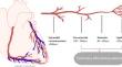 New avenues for the assessment of stable ischemic heart disease.