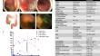 Effective Management of XLA Associated Enteropathy with Vedolizumab Monotherapy.