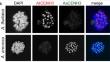 Centromere sequence-independent but biased loading of subgenome-specific CENH3 variants in allopolyploid Arabidopsis suecica.