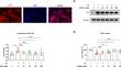 Caffeine upregulates SIRT3 expression to ameliorate astrocytes-mediated HIV-1 Tat neurotoxicity via suppression of EGR1 signaling pathway.