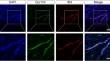 Role of Gpr124 in the Migration and Proliferation of Retinal Microvascular Endothelial Cells and Microangiopathies in Diabetic Retinopathy.