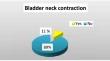 Evaluation of perioperative risk factors for bladder neck contracture after bipolar transurethral resection of the prostate.