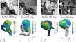 Imaging of Intracranial Aneurysms: A Review of Standard and Advanced Imaging Techniques.