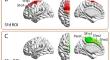 A revision of the dorsal origin of the frontal aslant tract (FAT) in the superior frontal gyrus: a DWI-tractographic study.