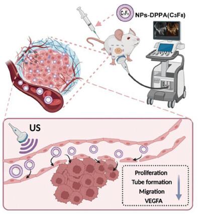 Bioactive Nanotherapeutic Ultrasound Contrast Agent for Concurrent Breast Cancer Ultrasound Imaging and Treatment.