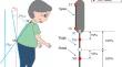 Continuous mobile measurement of camptocormia angle using four accelerometers.