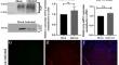 Differential expression of cellular prion protein (PrP<sup>C</sup>) in mouse hepatitis virus induced neuroinflammation.