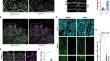 ACVR1/ALK2-p21 signaling axis modulates proliferation of the venous endothelium in the retinal vasculature.