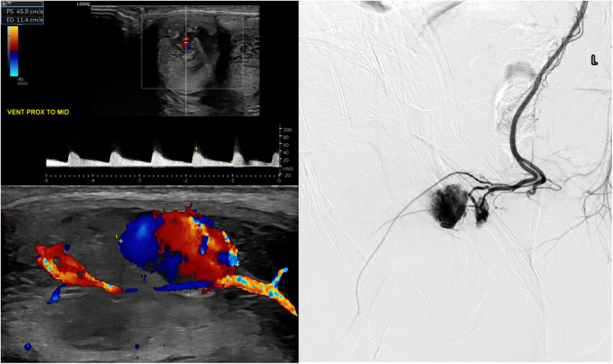 Review of the role of imaging in the diagnosis of priapism.