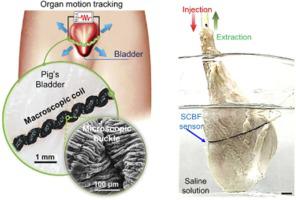 Synergistic effect of microscopic buckle and macroscopic coil for self-powered organ motion sensor