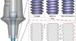 Effect of Thread Design Parameters on Central Screw Loosening: A 3D Finite Element Analysis