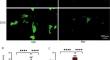 Marein Alleviates Doxorubicin-Induced Cardiotoxicity through FAK/AKT Pathway Modulation while Potentiating its Anticancer Activity.