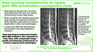 Deep learning reconstruction for lumbar spine MRI acceleration: a prospective study.