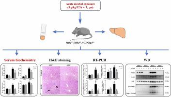 MLKL deficiency alleviates acute alcoholic liver injury via inhibition of NLRP3 inflammasome