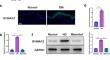 Targeting S100A12 to Improve Angiogenesis and Accelerate Diabetic Wound Healing.