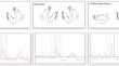 The excitability of ipsilateral motor evoked potentials is not task-specific and spatially distinct from the contralateral motor hotspot.