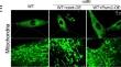 Correction to: Pum2-Mff axis fine-tunes mitochondrial quality control in acute ischemic kidney injury.