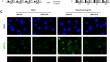 Targeted delivery of FAK siRNA by engineered exosomes to reverse cetuximab resistance via activating paraptosis in colon cancer