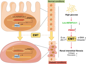 LncRNA KIFAP3-5:1 inhibits epithelial-mesenchymal transition of renal tubular cell through PRRX1 in diabetic nephropathy.