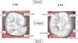 Frequency and variability of nonmetric dental crown traits of primary and permanent molars in a group of orthodontic patients.