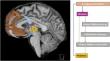 Fatigue in multiple sclerosis: can we measure it and can we treat it?