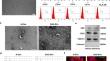 Extracellular vesicles derived from "serum and glucose" deprived HUCMSCs promoted skin wound healing through enhanced angiogenesis.