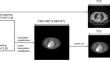 MultiRoiMix: A Data Augmentation Method for PET/CT Multimodal Medical Images