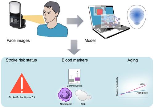 Prediagnosis recognition of acute ischemic stroke by artificial intelligence from facial images