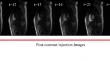 Deep learning-based segmentation of left ventricular myocardium on dynamic contrast-enhanced MRI: a comprehensive evaluation across temporal frames.