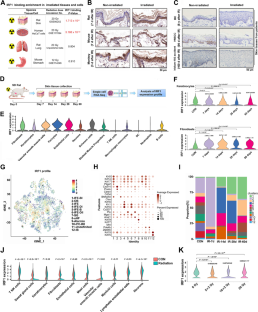 Chaperone- and PTM-mediated activation of IRF1 tames radiation-induced cell death and the inflammatory response