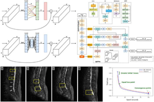 Enhanced deep leaning model for detection and grading of lumbar disc herniation from MRI.