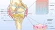 The emerging role of the semaphorin family in cartilage and osteoarthritis.