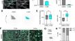 P300 Modulates Endothelial Mechanotransduction of Fluid Shear Stress