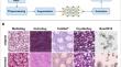 Automatic cancer nuclei segmentation on histological images: comparison study of deep learning methods